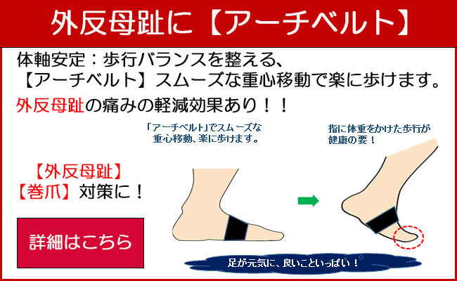 アーチベルト