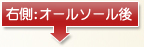 右側 オールソール後